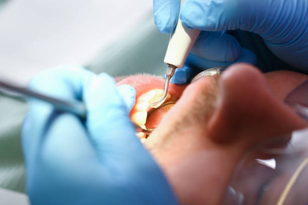Best Walk-In Emergency Dentist in Tyler, MN