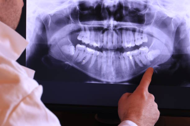Best Pediatric Emergency Dentist in Tyler, MN